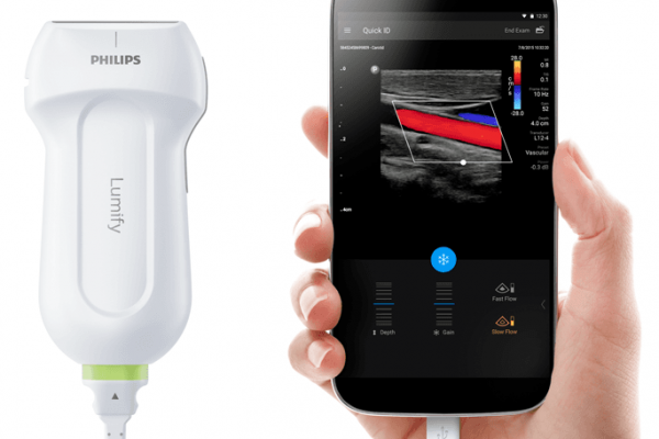 lumify ultrasound system