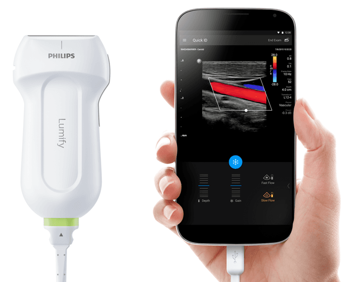 lumify ultrasound system